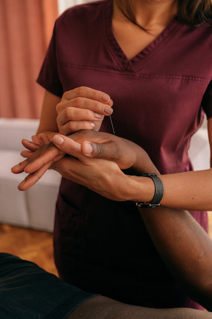 Professional acupuncturist performing hand acupuncture treatment indoors.